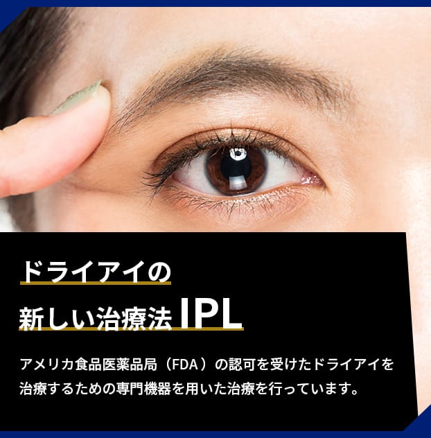 ドライアイの新しい治療法IPL