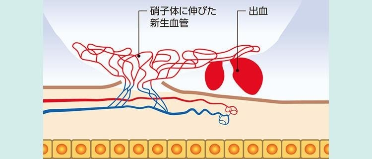 原因