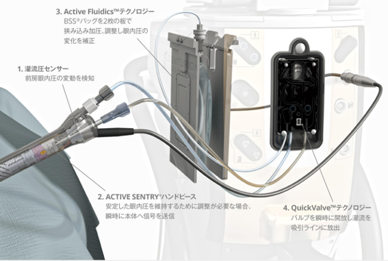 白内障手術装置