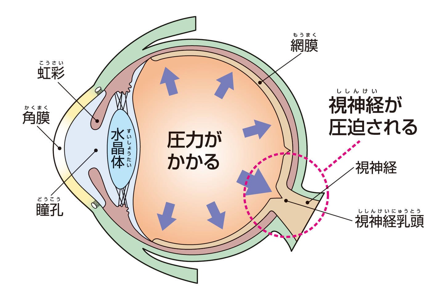 眼圧が高い状態