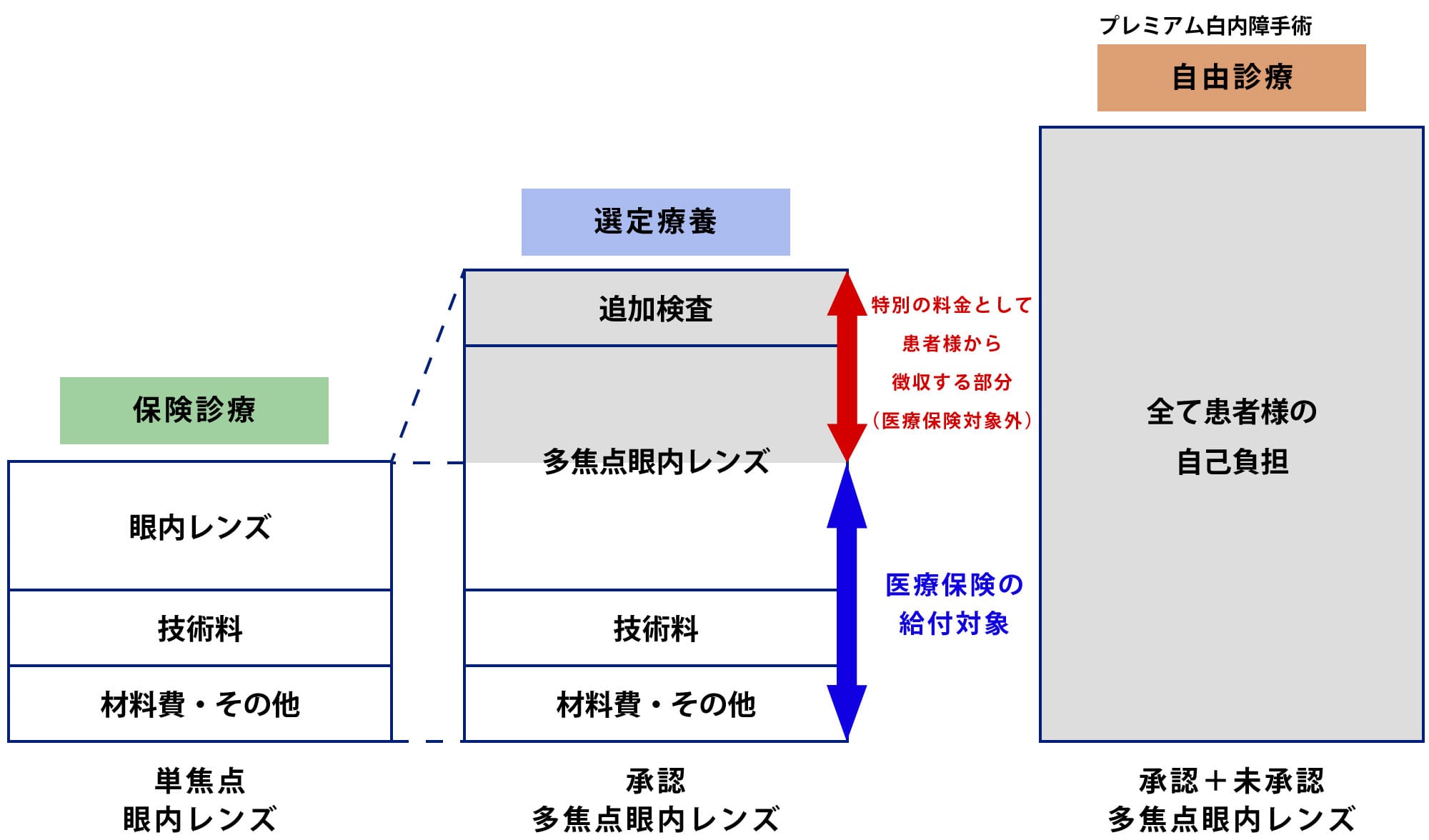 多焦点眼内レンズ